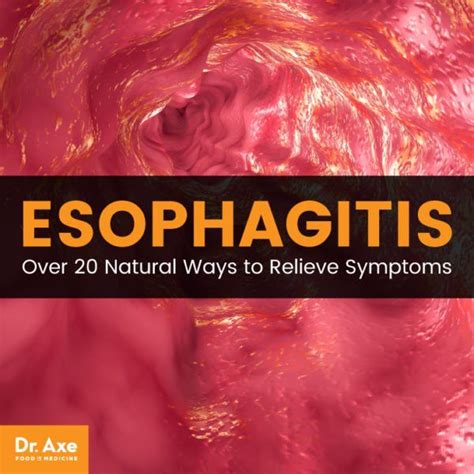 How To Treat Esophagitis Pain