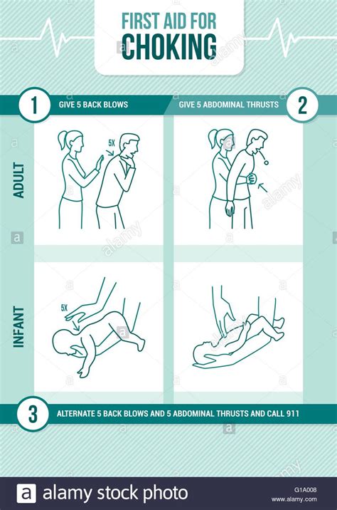 First Aid Procedure For Choking And Heimlich Maneuver For Adults And Infants Stock Vector Image