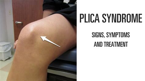 Plica Syndrome Signs Symptoms And Treatment Of This Uncomfortable Knee Pain Youtube