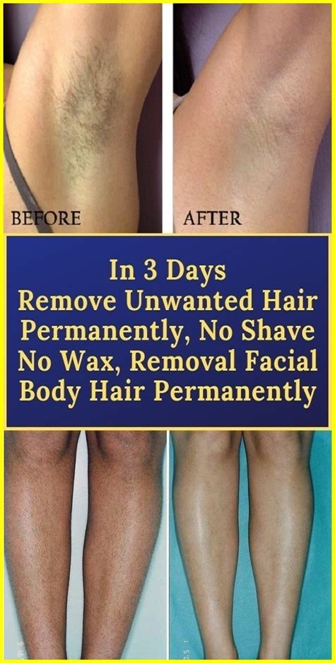 REMOVE UNWANTED HAIR PERMANENTLY IN THREE DAYS NO SHAVE NO WAX