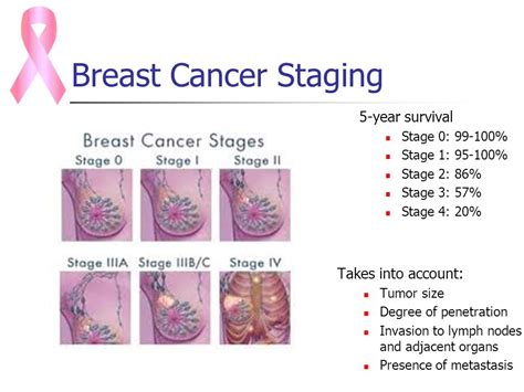 What Are The Symptoms Of Stage 1 Breast Cancer