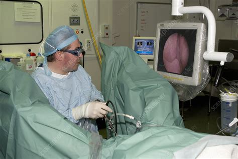 Endoscopic Prostate Surgery Stock Image M Science Photo