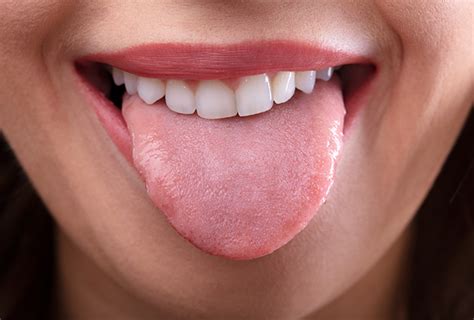 Tongue Analysis The Naturopathy Clinic