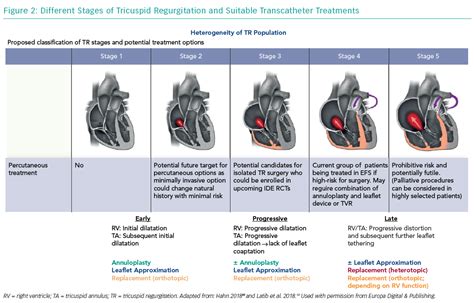 Different Stages Of Tricuspid Regurgitation And Suitable Transcatheter