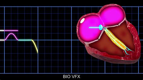 Video Animation Conduction Of Electrical Impulses Through The Heart