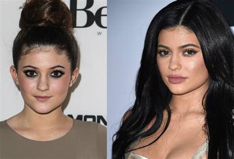 New And Improved The Top 15 Celebrity Plastic Surgeries For The Win