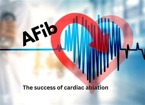 Afib And The Success Of The Cardiac Ablation Procedure Outbreak News