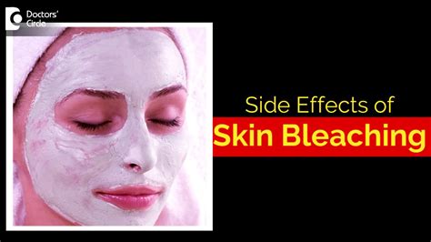 What Are The Side Effects Of Bleaching Your Skin Dr Aruna Prasad