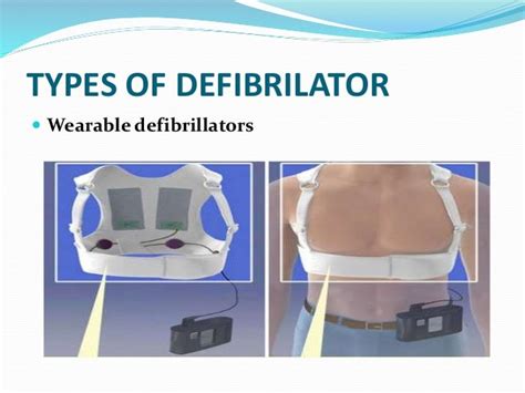 Cpr Acls Defibrillation