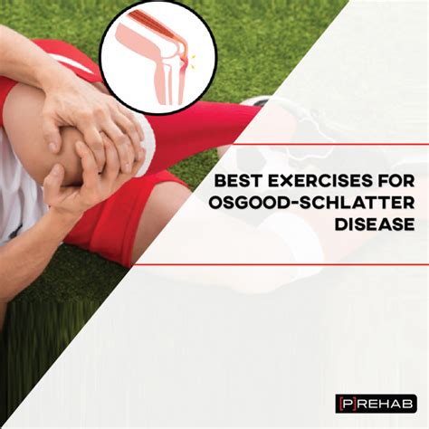 Best Exercises For Osgood Schlatter Disease 𝗣 𝗥𝗲𝗵𝗮𝗯