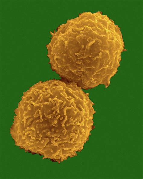 Human Stem Cells From Bone Marrow 1 By Dennis Kunkel Microscopy