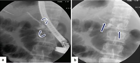 Imaging Of The Pancreas Radiology Key