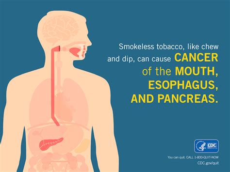 Infographics Smoking And Tobacco Use Cdc