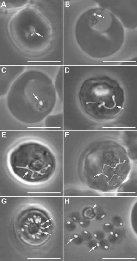 Plasmodium Falciparum Apicoplast Morphology In Live Cells Throughout