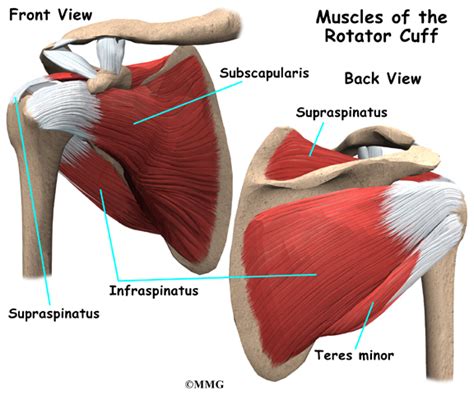The rotator cuff is the group of muscles and connecting tendons which help to move and stabilise the shoulder joint. Calcific Tendonitis of the Shoulder | eOrthopod.com