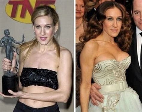 Celebrity Before After Plastic Surgery Celebrity Plastic Surgery Plastic Surgery Celebrities