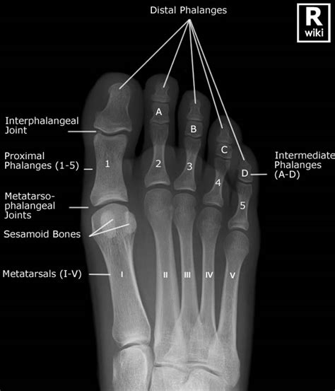 The feet are flexible structures of bones, joints, muscles, and soft tissues that let us stand upright and perform activities like walking, running, and jumping. Foot X-ray anatomy