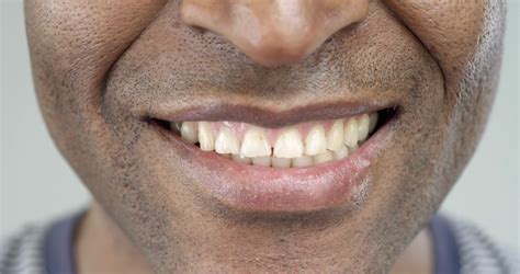 Extreme Close Up Of A Smile Of An Afro American Manthe African