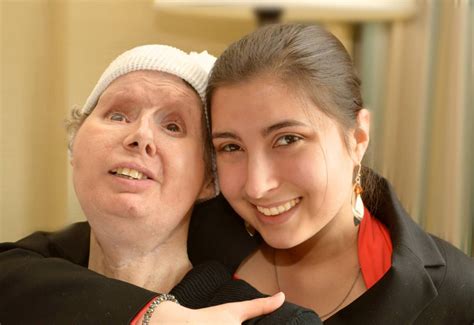 Charla Nash Wants Her Day in Court | Connecticut Public