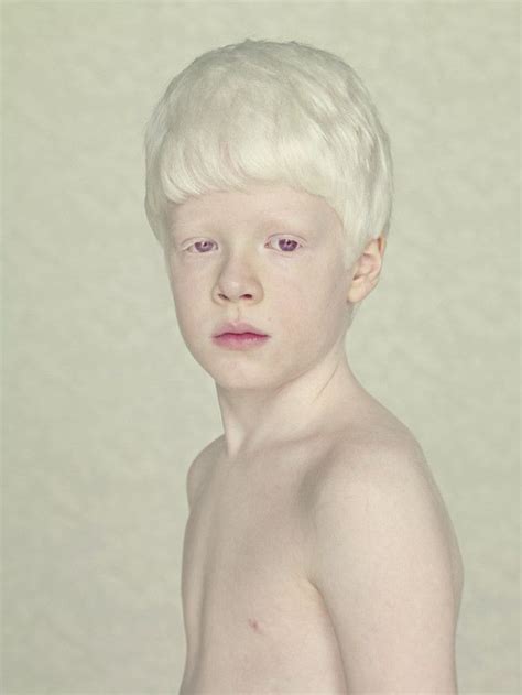 Images About Albino Beauty On Pinterest Tanzania Eyelashes And Albino African