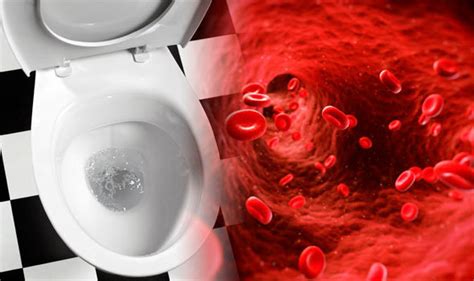 Blood In Urine Pictures