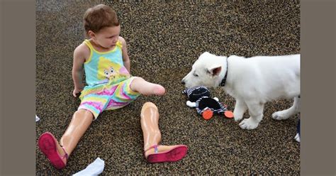 Girl Without Feet 3 Finds Perfect Match Puppy Missing Paw