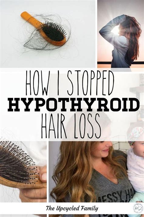 Suffering From Hypothyroid Hair Loss In Best Hair Loss Shampoo