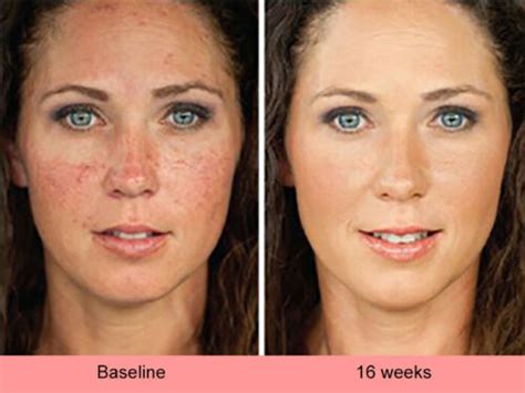 Skin Whitening Lightening Ultra Face Brightening Serum Dark Spot