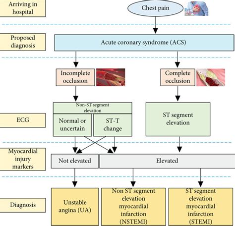 Classification Of The Acute Coronary Syndrome Download Scientific