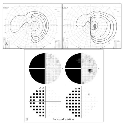 Peli Gottlieb And Chadwick Prisms Download Scientific Diagram