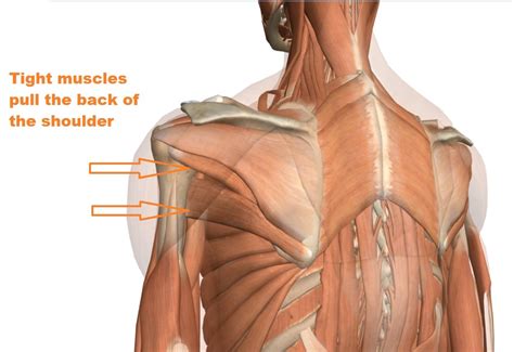 Shoulder Ligament Injuries Innova Pain Clinicinnova Pain Clinic