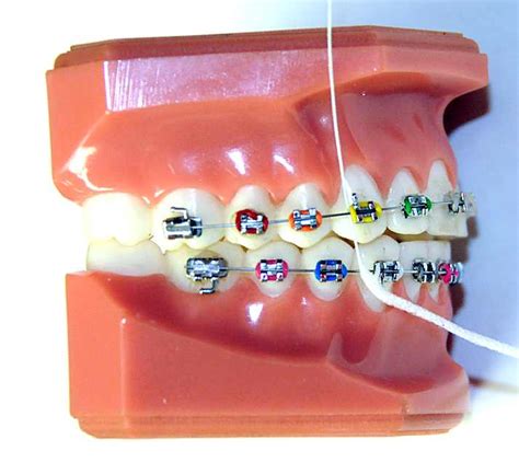 While there are many brands and types of floss that work with a threader, you may find a waxed floss approved by the american dental association is less likely to shred and easier to use. How Do You Floss with Braces? | Ask an Orthodontist.com