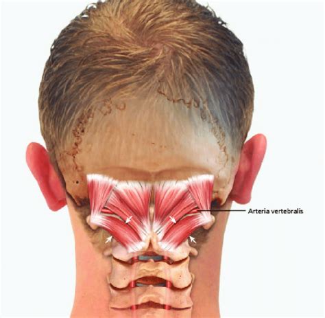 Anatomy Of Short Neck Muscles Short Neck Muscles With Marked Obliquus