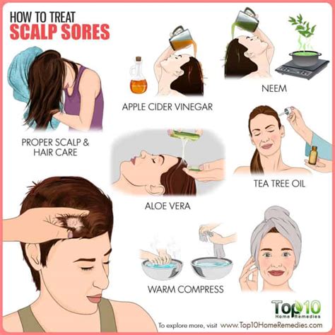 How To Treat Scalp Sores Top 10 Home Remedies