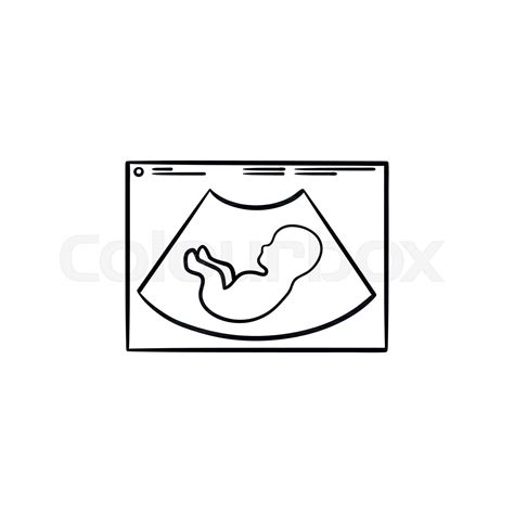 Fetus Silhouette On Ultrasound Hand Drawn Outline Doodle Icon Stock