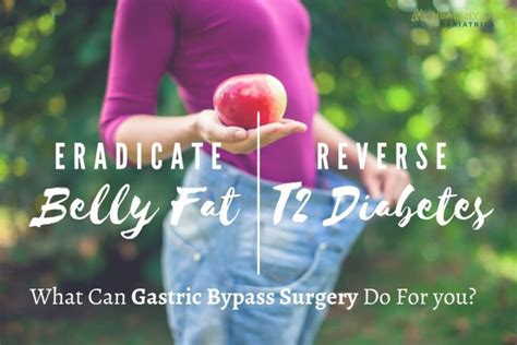 Gastric Bypass Procedure Archives Healthy Life Bariatrics