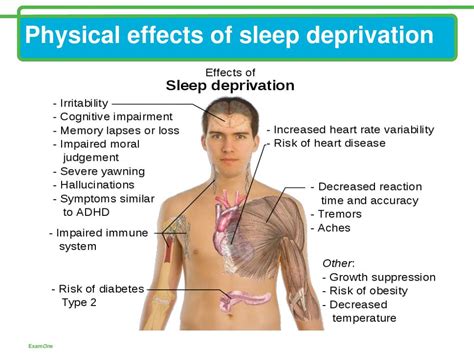 Ppt Sleep Deprivation Can It Kill Us Powerpoint Presentation Free Download Id1047593