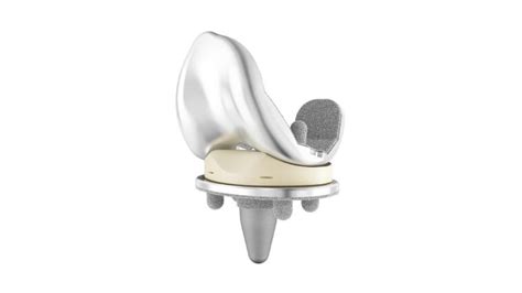 Attune® Cementless Knee System Depuy Synthes
