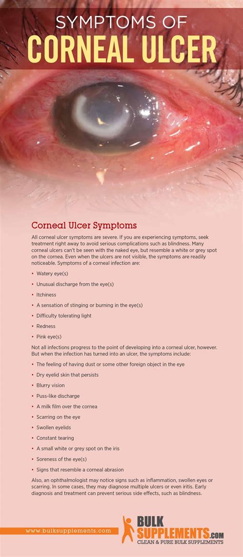 In an advanced case, a perforation may develop on the corneal. Corneal Ulcer: Characteristics, Causes & Treatment