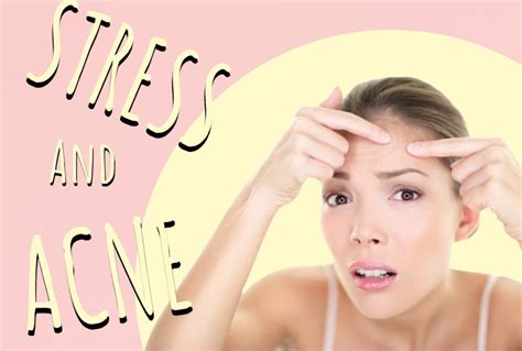 Tips To Help With Stress Acne Helloskin