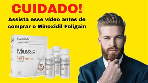 Minoxidil Sabe Como Aplicar Saiba Antes De Usar Youtube