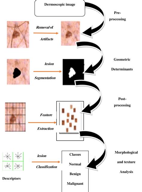 The Process An Early Diagnosis Skin Lesions Classification Using Masits