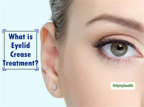 Eyelid Crease Treatment Heres The Complete Guide On It Onlymyhealth
