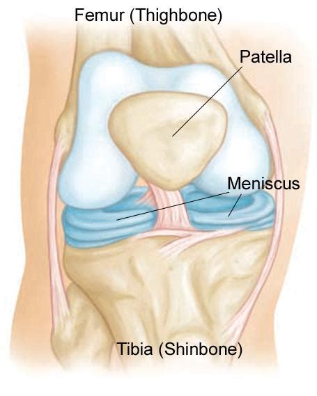Anda ada masalah lutut bengkak akibat serangan gout? Ketahui Penyebab Sering Merasa Nyeri di Belakang Lutut