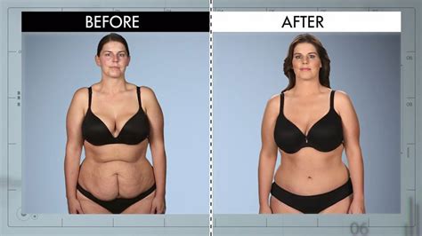 Belly Butt From Botched Patients Before And After Shocking Transformations E News