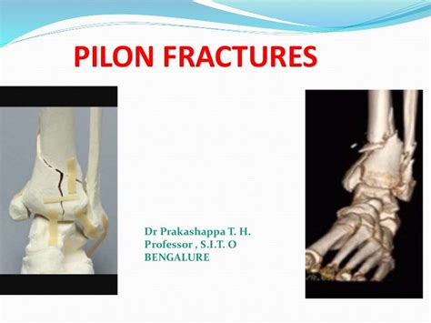 Pilon Fractures