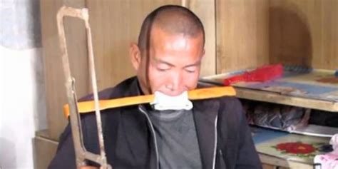 Zheng Yanliang Chinese Farmer Amputates Own Right Leg With Fruit Knife And Hacksaw Huffpost