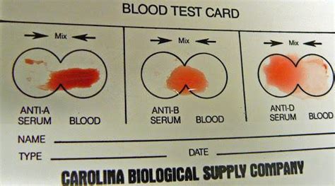 Learn about the different types of blood tests and what they mean here. front