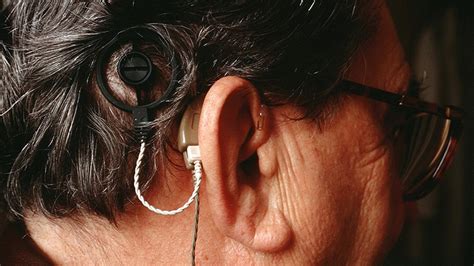 International Consensus Supports Wider Use Of Cochlear Implants