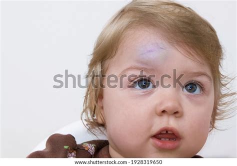 Forehead Bumps Over 335 Royalty Free Licensable Stock Photos